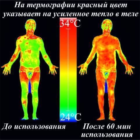 Нейролептики нового поколения: комфортный путь к душевному здоровью